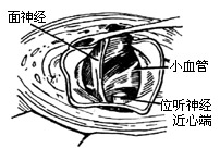 听神经 听神经
