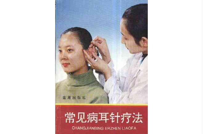 常见病耳针疗法