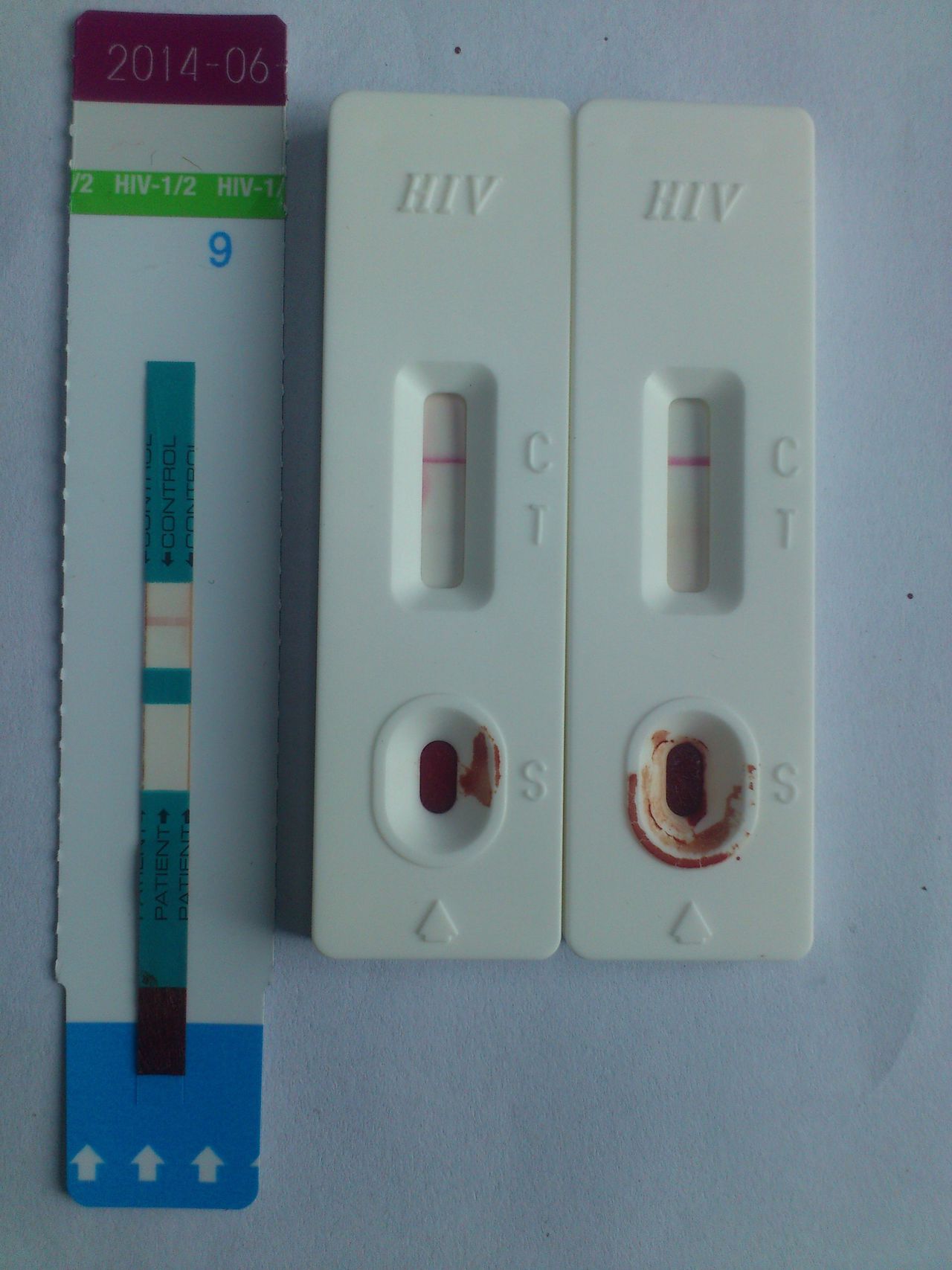 HIV试纸